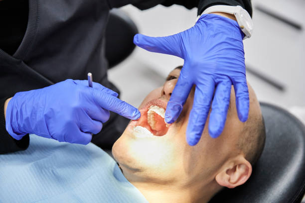 Best Chipped Tooth Repair Near Me  in Ridgefield, WA